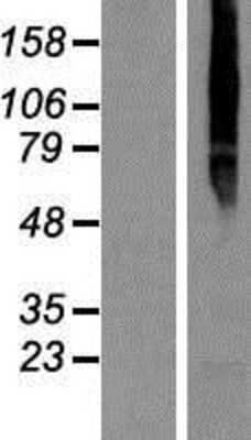 Western Blot: TMEM8 Overexpression Lysate [NBP2-06532]