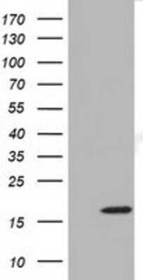 Western Blot: TMEM80 Antibody (OTI3A6) [NBP2-02750]