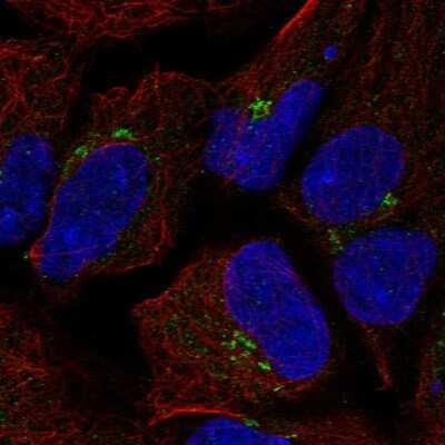 Immunocytochemistry/ Immunofluorescence: TMEM80 Antibody [NBP2-56647]