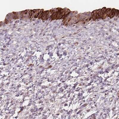 Immunohistochemistry: TMEM80 Antibody [NBP2-49503]