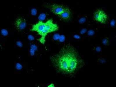 Immunocytochemistry/ Immunofluorescence: TMEM80 Antibody (OTI3A6) - Azide and BSA Free [NBP2-74546]