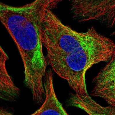 Immunocytochemistry/ Immunofluorescence: TMEM81 Antibody [NBP2-57182]