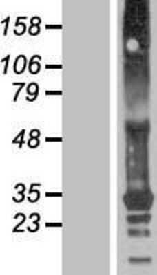 Western Blot: TMEM82 Overexpression Lysate [NBP2-08725]