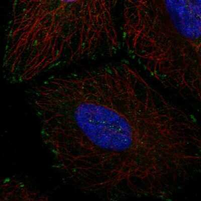 Immunocytochemistry/ Immunofluorescence: TMEM85 Antibody [NBP2-55507]