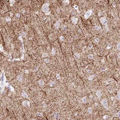 Immunohistochemistry-Paraffin: TMEM85 Antibody [NBP2-30406]