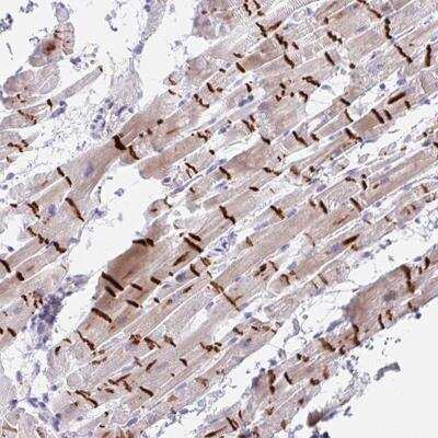 Immunohistochemistry-Paraffin: TMEM86A Antibody [NBP2-33816]