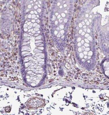Immunohistochemistry-Paraffin: TMEM86B Antibody [NBP2-31684]