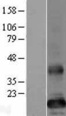 Western Blot: TMEM86B Overexpression Lysate [NBP2-05104]