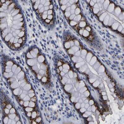 Immunohistochemistry-Paraffin: TMEM87A Antibody [NBP1-90532]