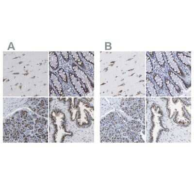 Immunohistochemistry-Paraffin: TMEM87A Antibody [NBP1-90532]