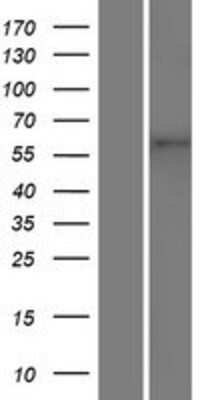 Western Blot: TMEM87A Overexpression Lysate [NBP2-07162]