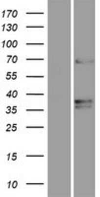 Western Blot: TMEM87A Overexpression Lysate [NBP2-09376]