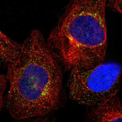 Immunocytochemistry/ Immunofluorescence: TMEM87B Antibody [NBP1-94006]
