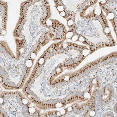 Immunohistochemistry-Paraffin: TMEM87B Antibody [NBP1-94006]