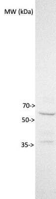 Western Blot: TMEM87B Antibody [NBP1-94006]