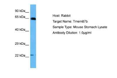 Western Blot: TMEM87B Antibody [NBP2-83699]