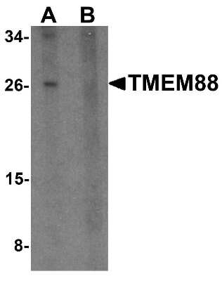 Western Blot: TMEM88 AntibodyBSA Free [NBP1-76591]