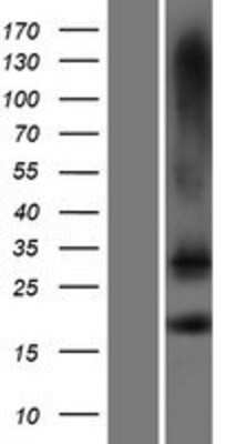 Western Blot: TMEM88 Overexpression Lysate [NBP2-04566]