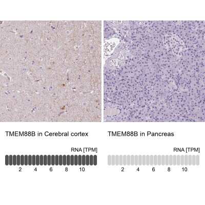 Immunohistochemistry-Paraffin: TMEM88B Antibody [NBP2-38078]