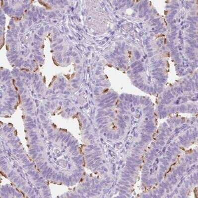 Immunohistochemistry: TMEM89 Antibody [NBP2-30826]