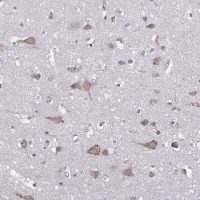 Immunohistochemistry-Paraffin: TMEM8C Antibody [NBP2-34175]