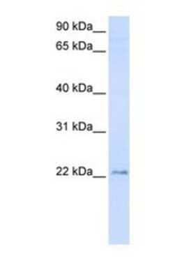 Western Blot: TMEM9 Antibody [NBP1-69589]