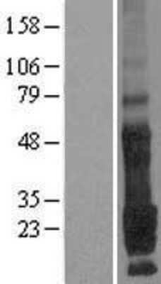 Western Blot: TMEM9 Overexpression Lysate [NBL1-17109]