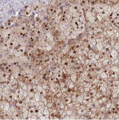 Immunohistochemistry: TMEM90A Antibody [NBP2-30935]