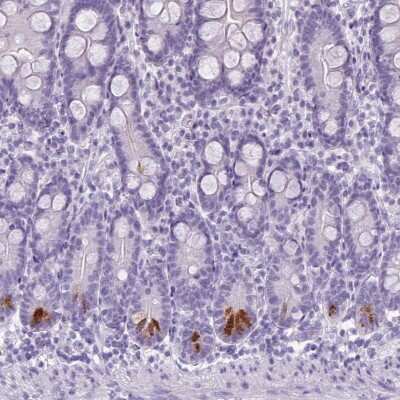 Immunohistochemistry-Paraffin: TMEM91 Antibody [NBP2-13458]