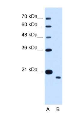 Western Blot: TMEM91 Antibody [NBP1-70730]