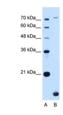 Western Blot: TMEM91 Antibody [NBP1-70731]