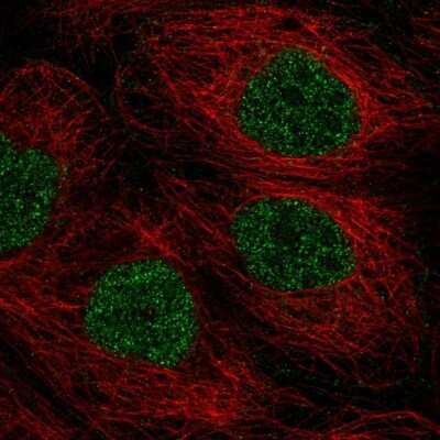 Immunocytochemistry/ Immunofluorescence: TMEM92 Antibody [NBP2-38013]