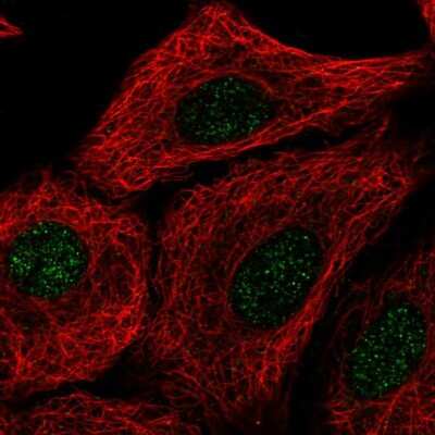 Immunocytochemistry/ Immunofluorescence: TMEM92 Antibody [NBP2-55771]