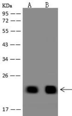 Western Blot: TMEM92 Antibody [NBP3-12676]