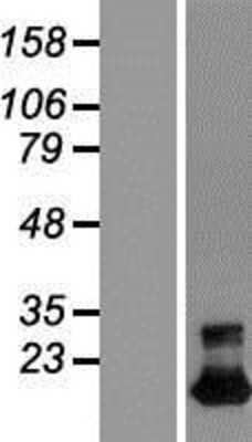 Western Blot: TMEM92 Overexpression Lysate [NBL1-17110]