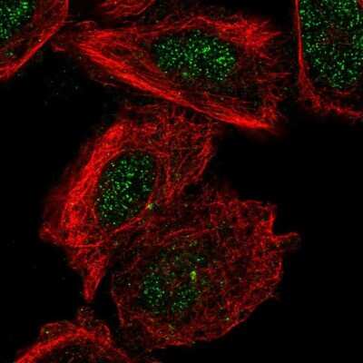 Immunocytochemistry/ Immunofluorescence: TMEM93 Antibody [NBP2-38000]