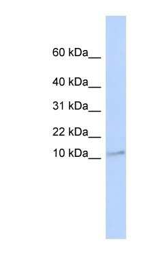 Western Blot: TMEM93 Antibody [NBP1-59735]