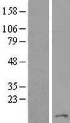 Western Blot: TMEM93 Overexpression Lysate [NBL1-17111]