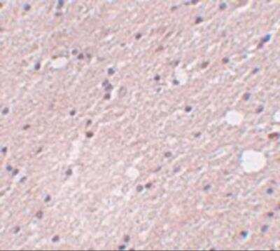 Immunohistochemistry: Preso/FRMPD4 Antibody - BSA Free [NBP2-82035]