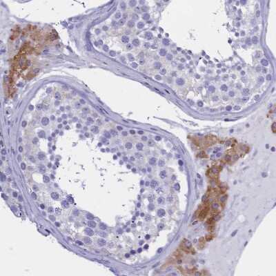 Immunohistochemistry-Paraffin: TMEM97 Antibody [NBP1-92522]