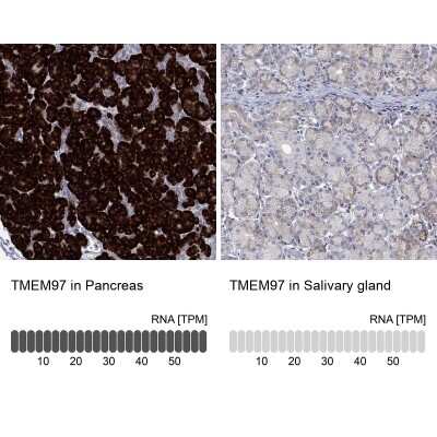 Immunohistochemistry-Paraffin: TMEM97 Antibody [NBP3-16973]