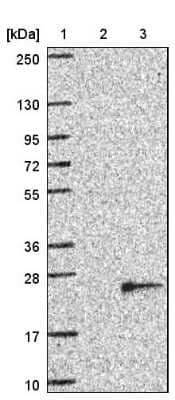 Western Blot: TMEM97 Antibody [NBP1-92522]