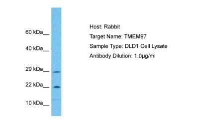 Western Blot: TMEM97 Antibody [NBP2-88443]