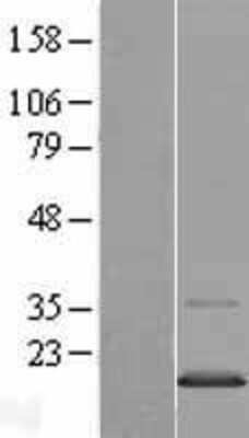 Western Blot: TMEM97 Overexpression Lysate [NBP2-07315]