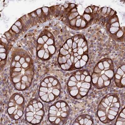 Immunohistochemistry-Paraffin: TMEM98 Antibody [NBP1-84154]