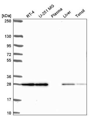 Western Blot: TMEM98 Antibody [NBP2-54914]