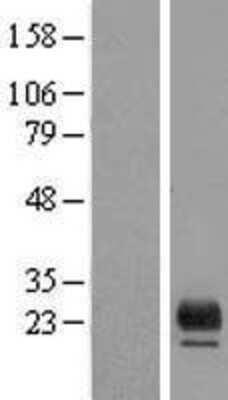 Western Blot: TMEM98 Overexpression Lysate [NBP2-09189]