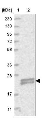 Western Blot: TMEM9B Antibody [NBP1-88545]