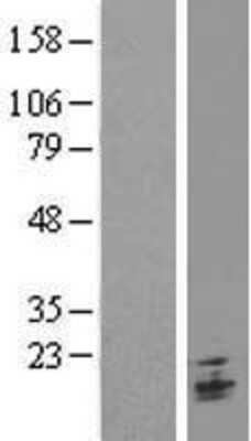 Western Blot: TMEM9B Overexpression Lysate [NBL1-17113]