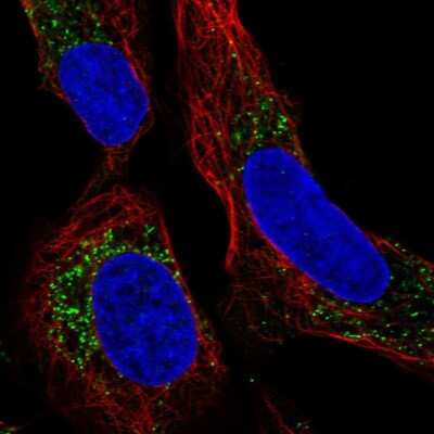 Immunocytochemistry/ Immunofluorescence: TMEPAI Antibody [NBP2-56657]